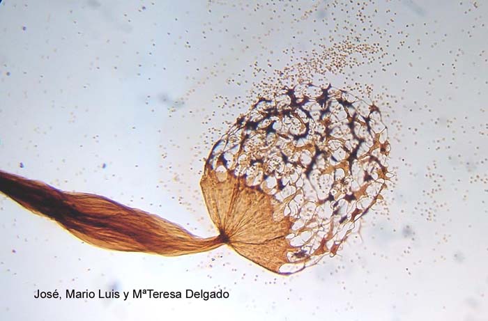 Cribraria aurantiaca  microscopia